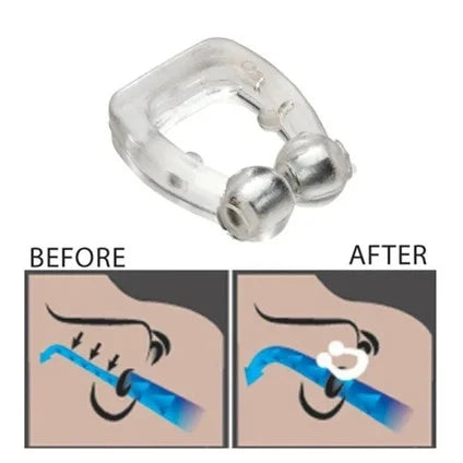 Anti-Snoring Ring