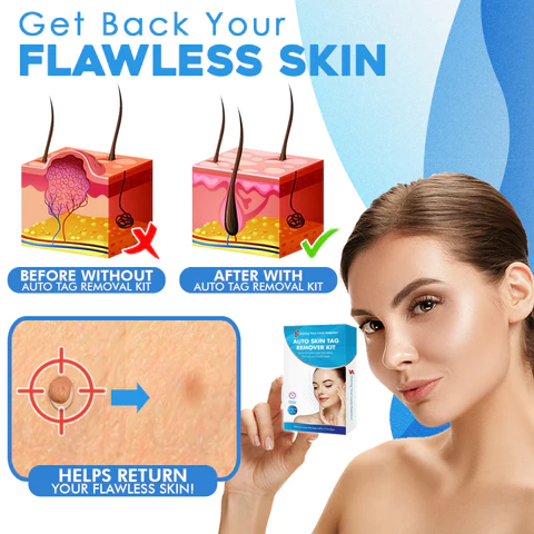 PAINLESS AUTO SKIN TAG REMOVER KIT