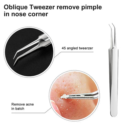 Professional Blackhead Remover